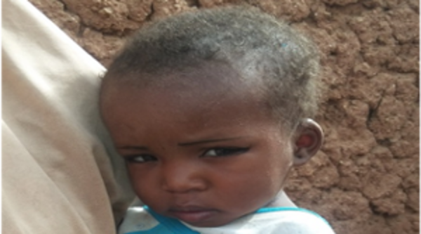 Nigeria: Fatima è migliorata